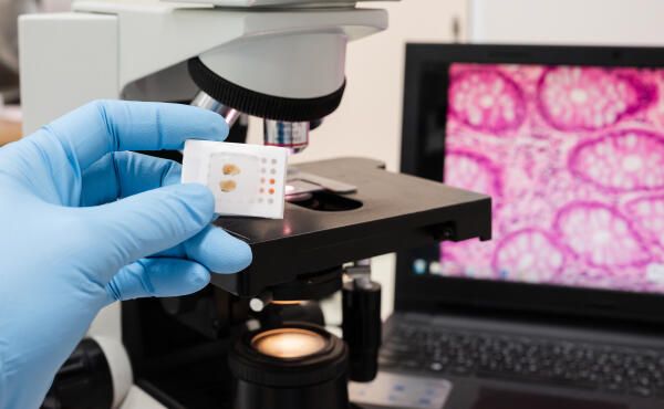 Pathologe untersucht Probe